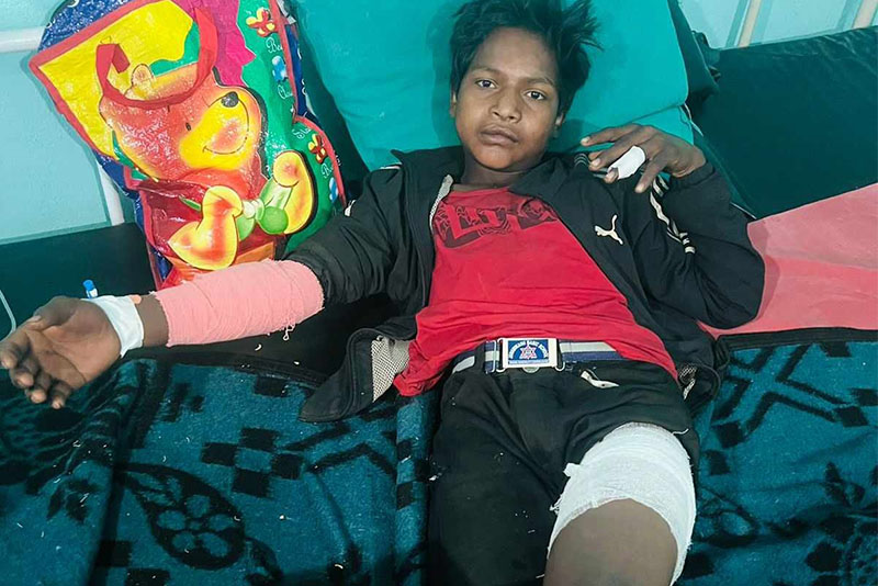 जंगली बँदेलको आक्रमणबाट बालक घाइते